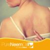 Pure Neem Oil by NatureNeem : The Best quality in neem oil production from India. For skin and many others applications.
