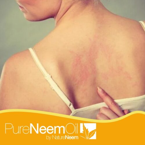 Pure Neem Oil by NatureNeem : The Best quality in neem oil production from India. For skin and many others applications.